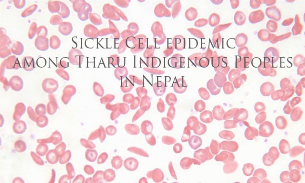 Save indigenous Tharus from Sickle Cell epidemic 